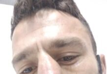 Davi Eliasquevici quebra o nariz e não pega Esquiva Falcão no B4Y