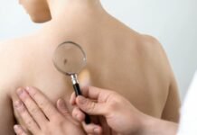 Dezembro Laranja – Incidência de câncer de pele é maior em homens